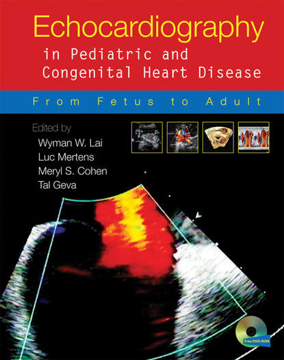 Echocardiography in Pediatric and Congenital Heart Disease - Группа авторов