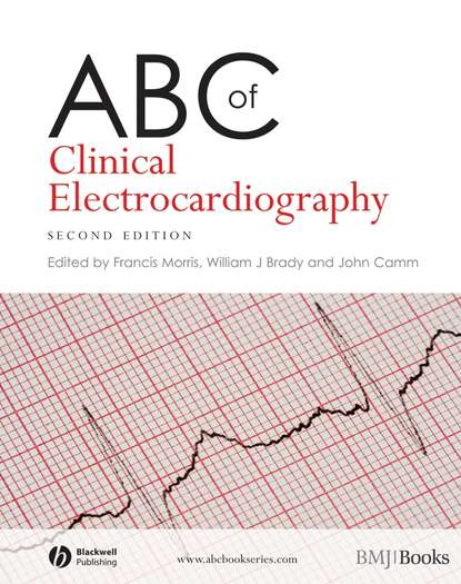 ABC of Clinical Electrocardiography - Группа авторов