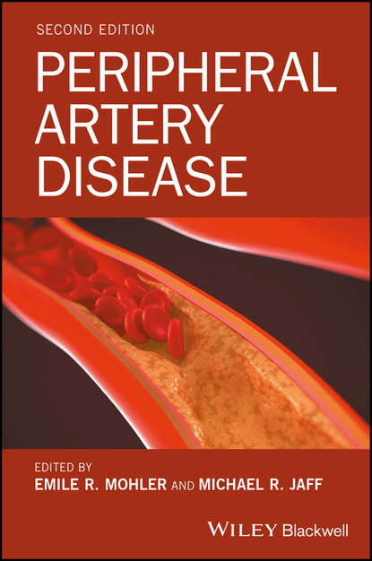 Peripheral Artery Disease - Группа авторов