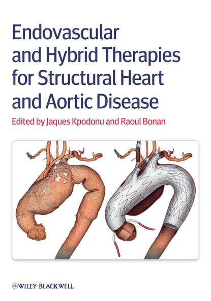 Endovascular and Hybrid Therapies for Structural Heart and Aortic Disease - Группа авторов