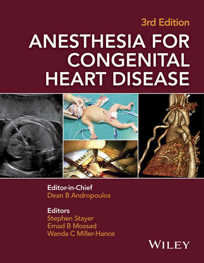 Anesthesia for Congenital Heart Disease - Группа авторов